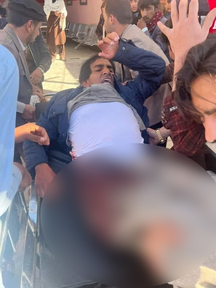 Mohsin Dawar injured in a firing incident