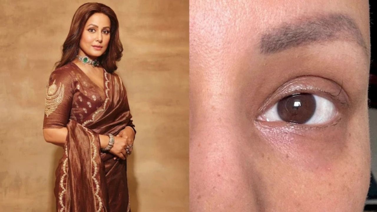 Hina Khan shares moving photo of chemo’s affect on her body